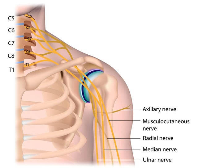 Brachial Plexus Injuries